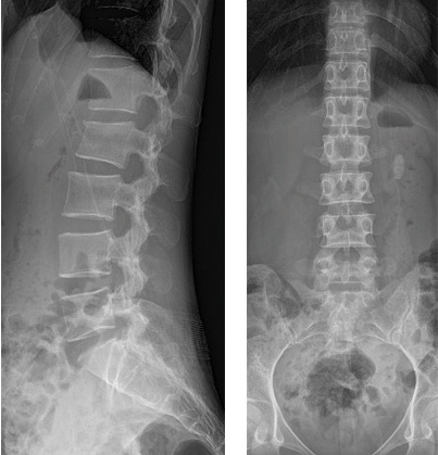 Light weighted DR Solution in Egypt
